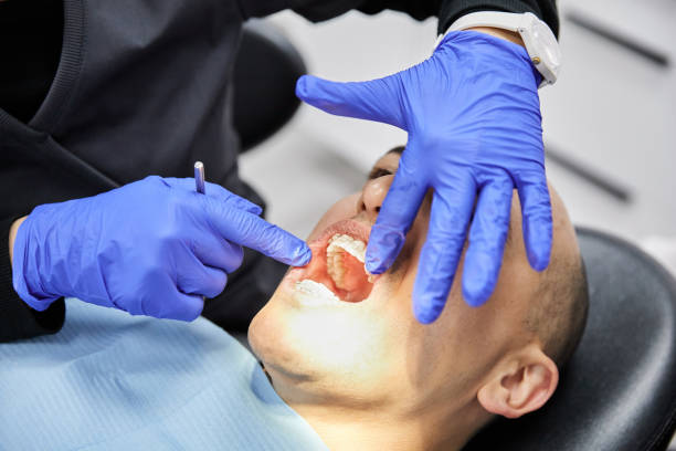 Best Emergency Dental Care for Sports Injuries in Avis, PA